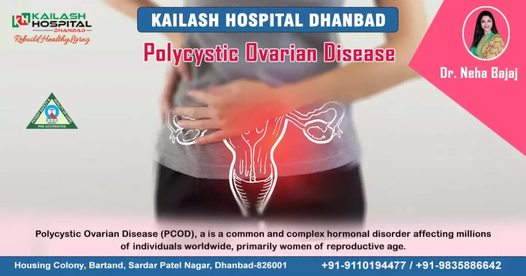 polycystic-ovarian-disease