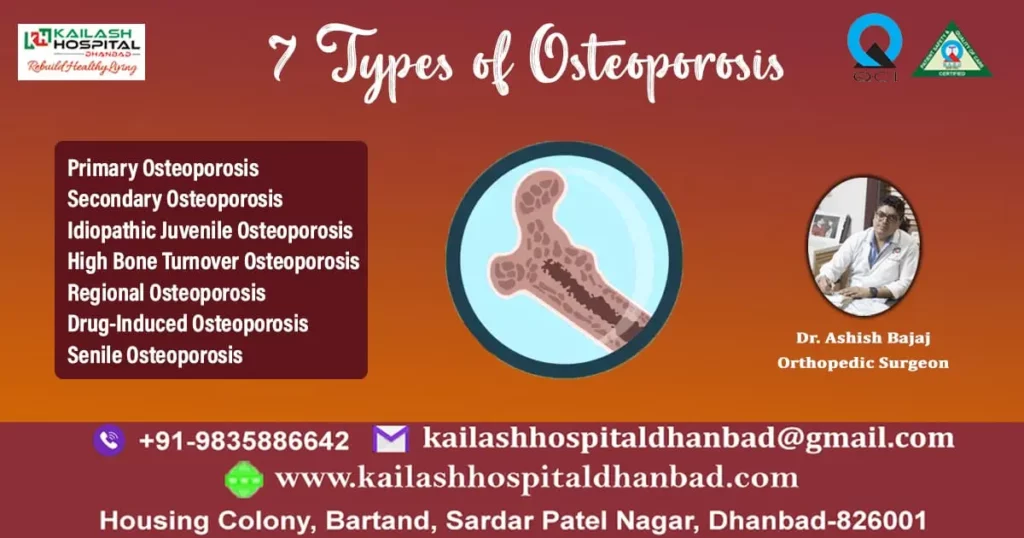 7-types-of-osteoporosis