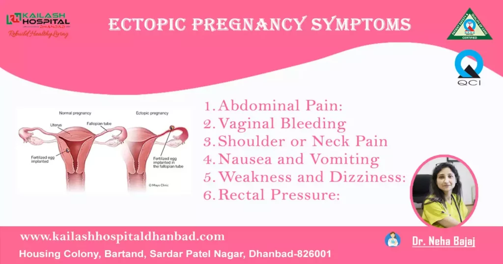 symptoms-of-ectopic-pregnancy