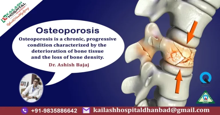 Understanding Osteoporosis: The Silent Threat to Bone Health