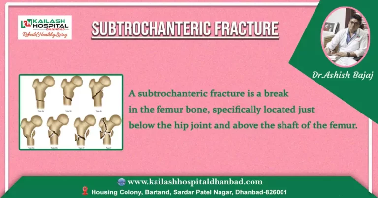 Understanding Subtrochanteric Fractures: Causes, Symptoms, Treatment and Recovery