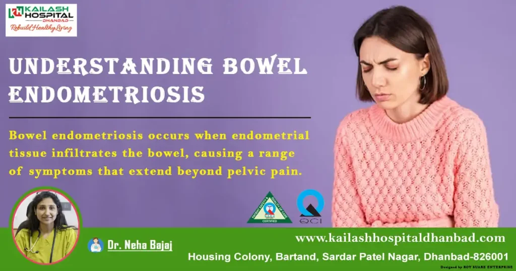 understanding-bowel-endometriosis