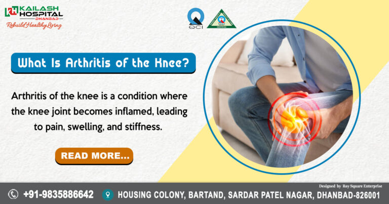what is knee arthritis