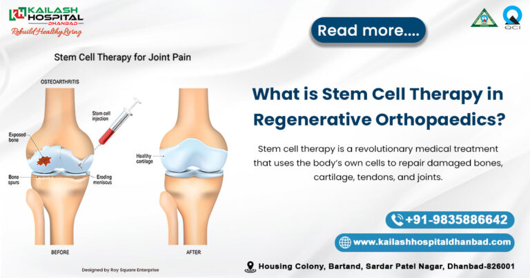 Stem Cell Therapy