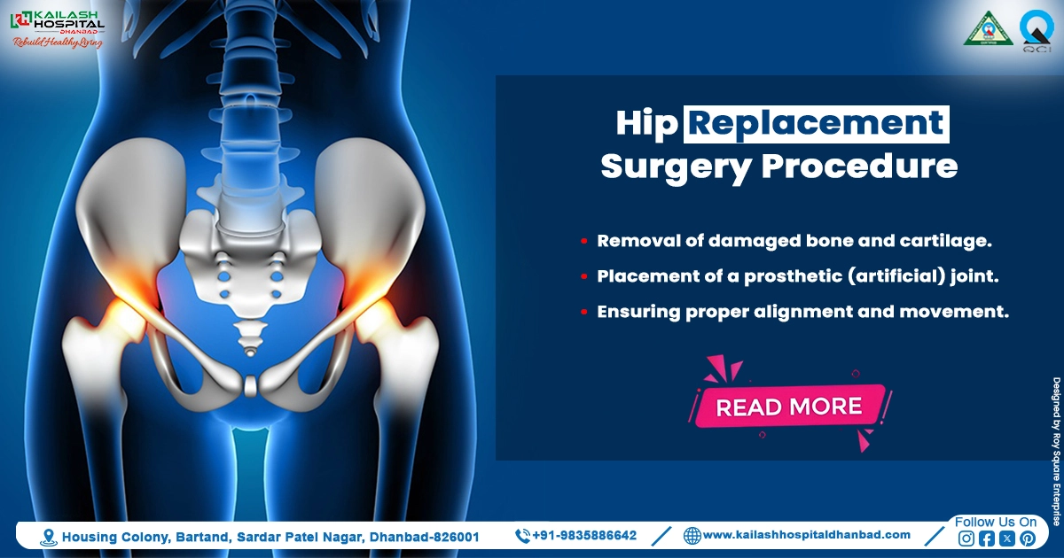  Hip Replacement Surgery Procedure